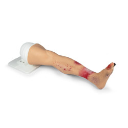 Simulateur médical – Jambe atteinte de pathologies Teamalex