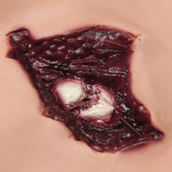 Kit d’accidentologie Teamalex Medical