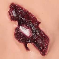 Kit d’accidentologie Teamalex Medical