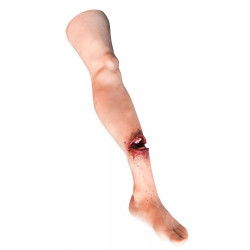 Jambe avec fracture ouverte Teamalex Medical