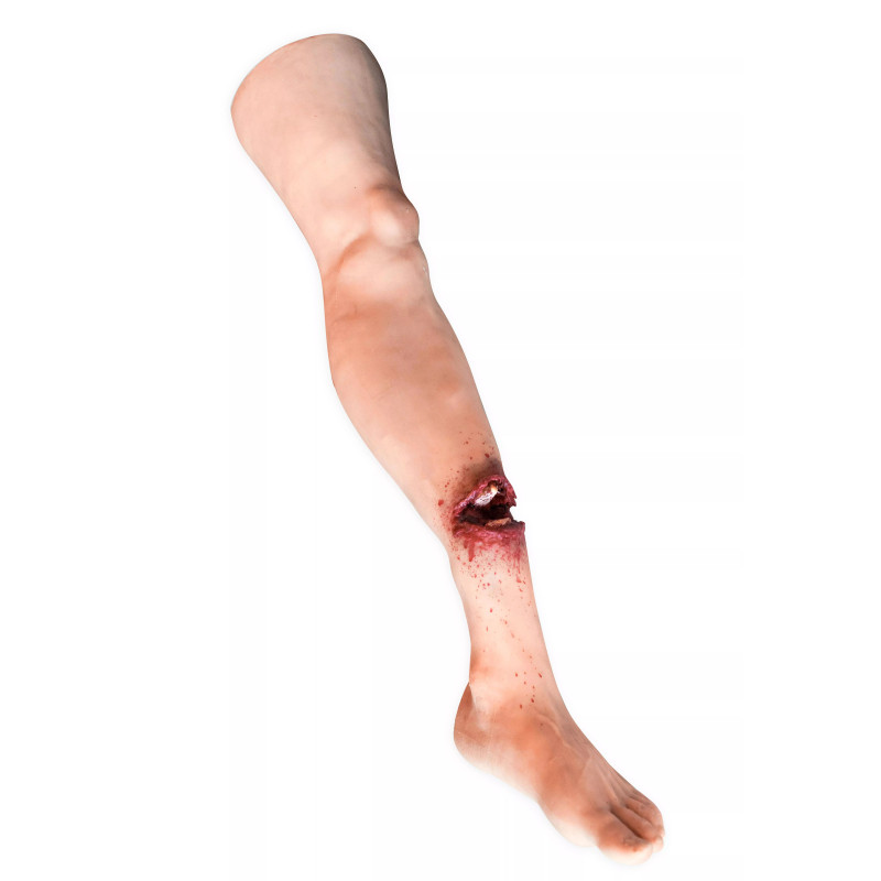 Jambe avec fracture ouverte Teamalex Medical